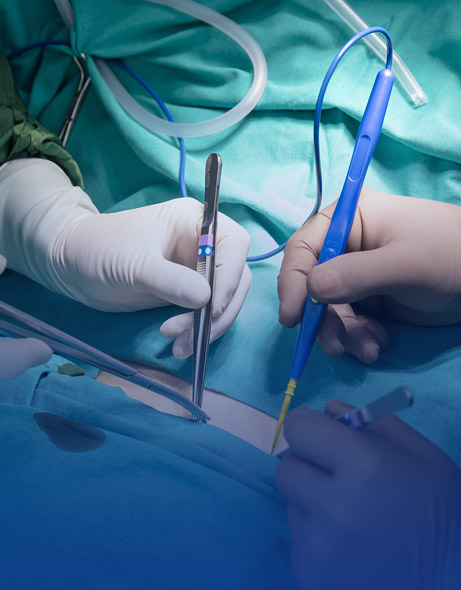 Strumenti chirurgici